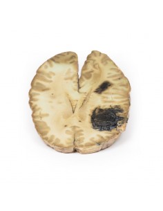 Emorragia cerebrale,... 2