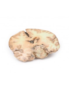 Glioblastoma multiforme -... 2