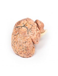 Craniofaringioma - Erler... 2