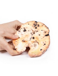 Melanoma metastatico -... 2