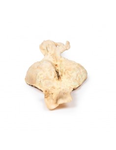 Aneurisma dell'aorta... 2