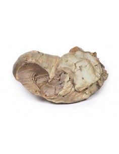 Valvola aortica bicuspide -... 2