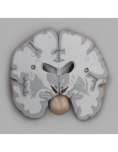 Erler Zimmer, modello... 2