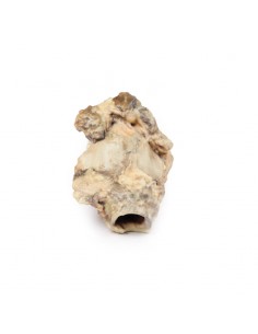 Carcinoma della fossa... 2