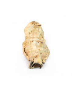 Carcinoma della laringe -... 2