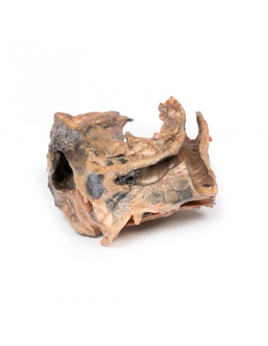 Corpo estraneo inalato: trachea -...
