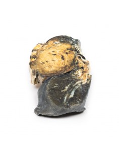 Tumore metastatico nel...