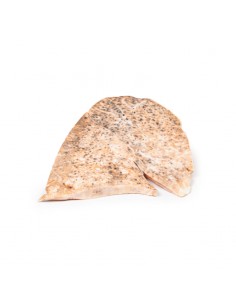 Tubercolosi miliare del...