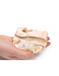 Trachea: linfoma di...