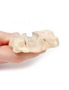 Trachea: linfoma di... 2