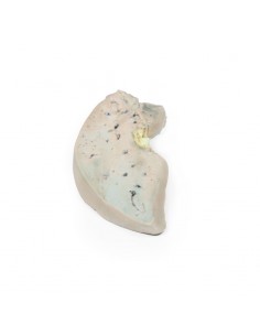 Fegato grasso - Erler... 2