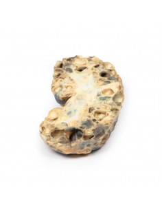 Malattia del rene...