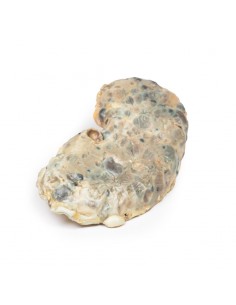 Malattia del rene... 2