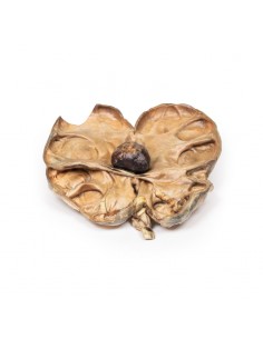 Idronefrosi e idrouretere...