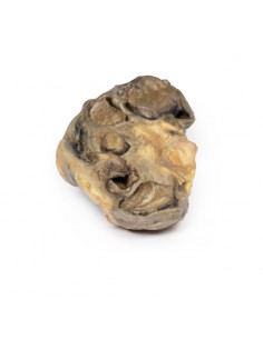 Pionefrosi - Erler Zimmer...