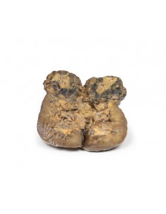 Carcinoma delle cellule...