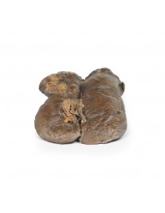 Carcinoma delle cellule... 2