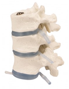 Erler Zimmer, modello...