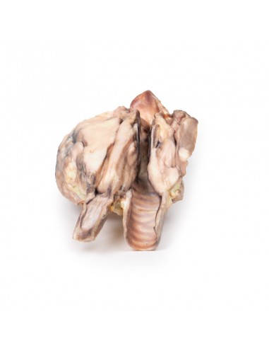 Linfoma della tiroide - Erler Zimmer... Linfoma della tiroide - Erler Zimmer...