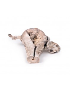 Carcinoma endometriale -...