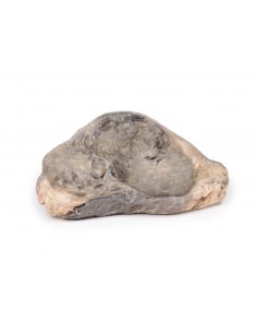 Carcinoma della mammella -...