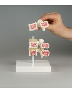 Erler ZImmer, modello...