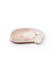 Leiomioma uterino - Erler...