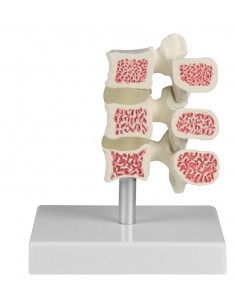 Erler ZImmer, modello... 2