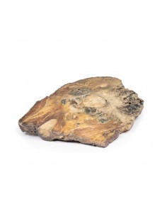 Condrosarcoma del femore e... 2