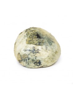 Sifilide terziaria - Erler...