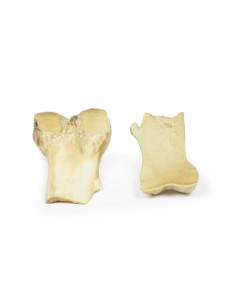 Osteocondroma - Erler...