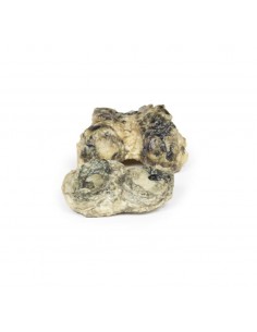 Artrite infettiva del...