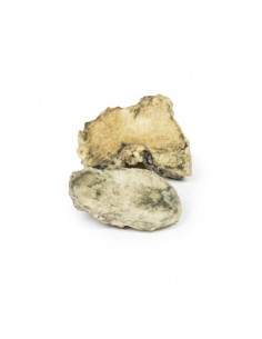 Artrite infettiva del... 2