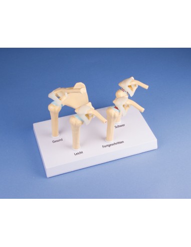 Erler Zimmer, modello anatomico di 4...