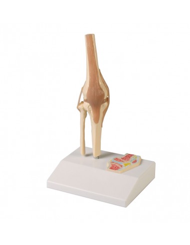 Erler Zimmer, modellino anatomico di...