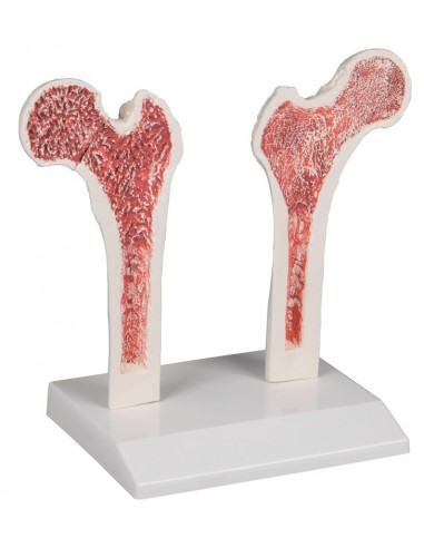 Erler Zimmer, modello anatomico di...