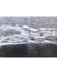 Trainer per ecografia... 2