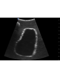 Trainer per ecografica...