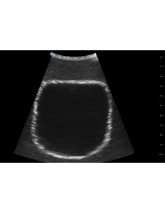 Trainer per ecografica... 2