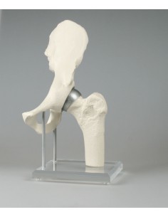 Erler Zimmer, modello... 2