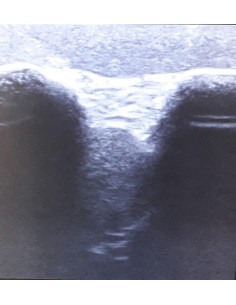 Simulatore per l'ecografia... 2