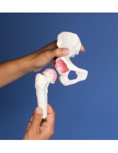 Erler Zimmer, modello...