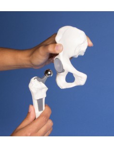 Erler Zimmer, modello... 2