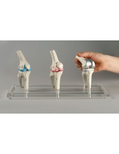 Erler Zimmer, modello...