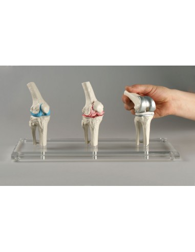 Erler Zimmer, modello anatomico di...