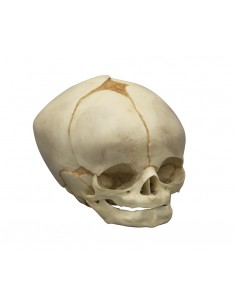 Collezione di crani di feto...