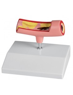 Erler Zimmer, modello...