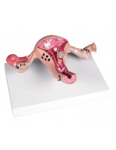 Erler Zimmer, modello...