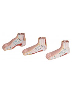 Piede normale, piede cavo,...