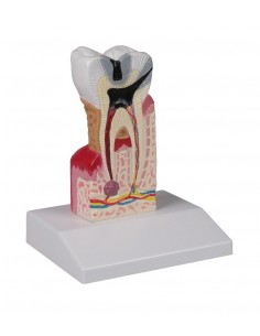 Erler Zimmer, modello...